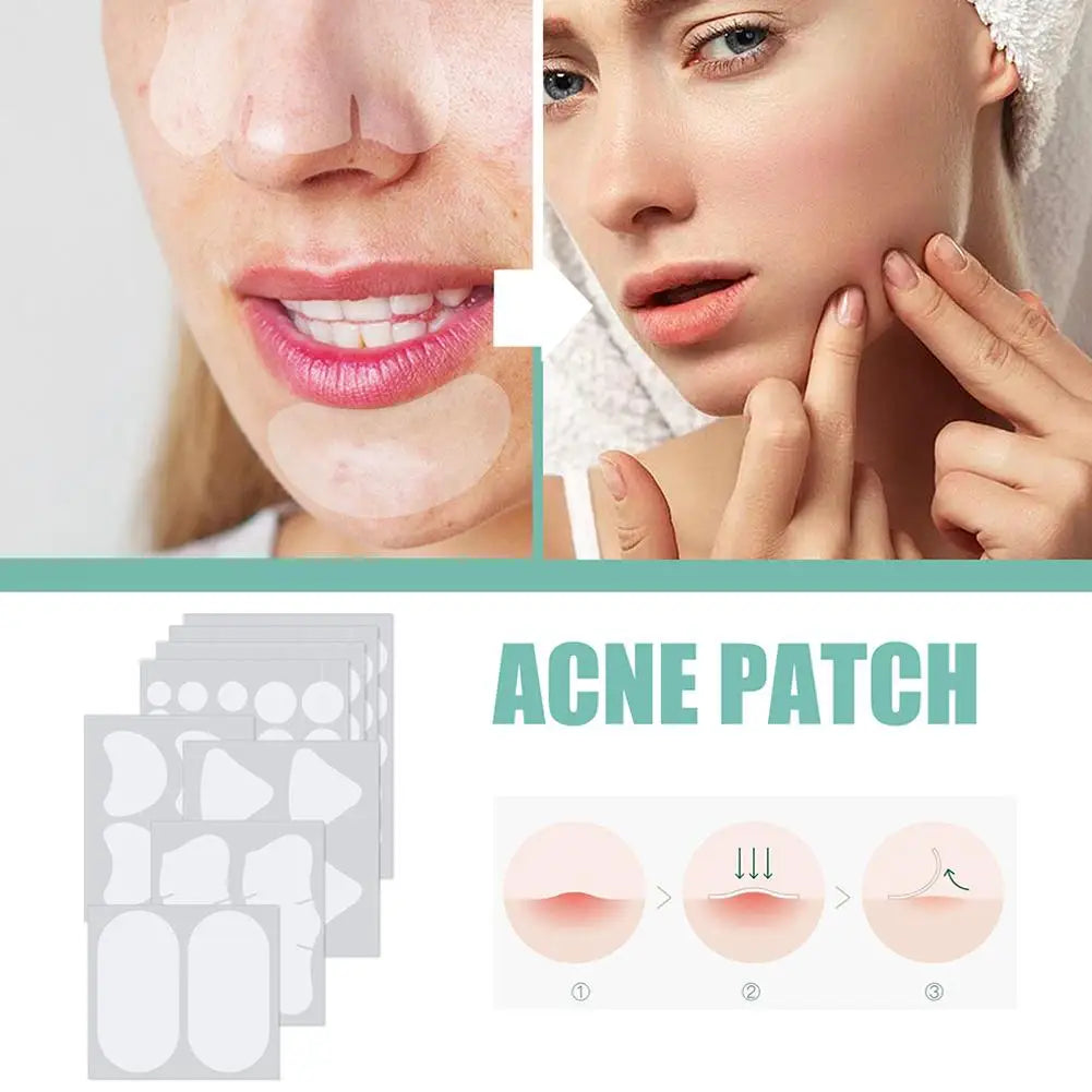 132pcs Invisible Removal Pimple Anti-Acne Hydrocolloid Patches Spots Marks Concealer Repair Sticker Waterproof