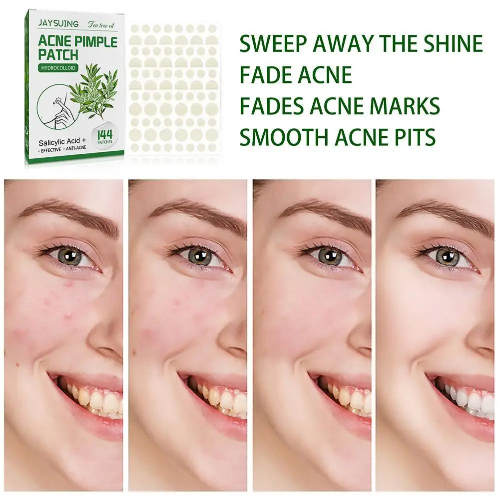 144Pcs/set Acne Pimple Patches Translucent Matte Hydrocolloid Salicylic Acid Tea Tree Oil For Inflamed Acne Improve Whiteheads